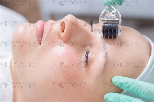 Portrait of a woman's face with problem skin. Peeling procedure. Natural beauty.