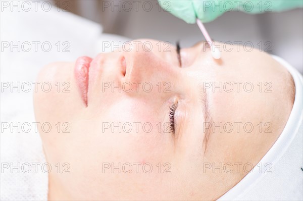 Portrait of a woman's face with problem skin. Peeling procedure. Natural beauty.