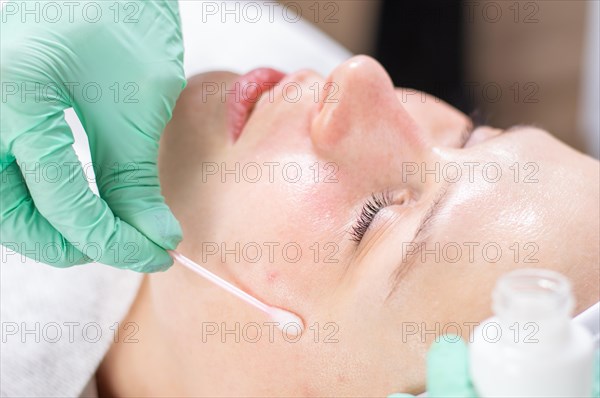 Portrait of a woman's face with problem skin. Peeling procedure. Natural beauty.