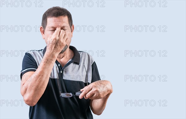 Senior man with eyestrain holding glasses isolated. Person with asthenopia holding glasses. Concept of person with visual problem