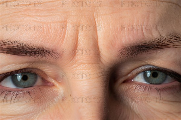 Close up of fron lines wrinkles between eyes of middle aged or elderly woman. KI generiert, generiert AI generated