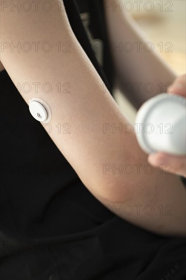 Child holding a setting aid for a glucose sensor, the sensor has been attached to the child's arm, blood glucose measurement, diabetes treatment, glucose measurement, Ruhr area, Germany, Europe