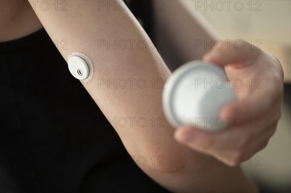 Child holding a setting aid for a glucose sensor, the sensor has been attached to the child's arm, blood glucose measurement, diabetes treatment, glucose measurement, Ruhr area, Germany, Europe