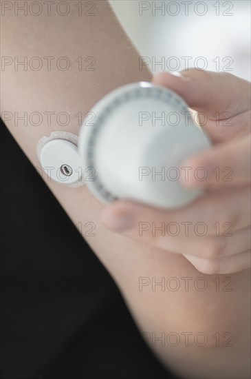 Child holding a setting aid for a glucose sensor, the sensor has been attached to the child's arm, blood glucose measurement, diabetes treatment, glucose measurement, Ruhr area, Germany, Europe