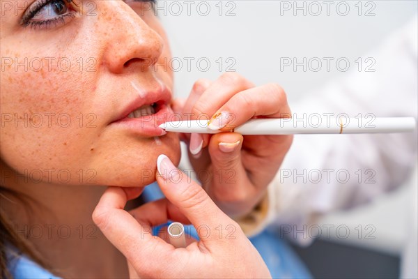Beautician draw correction lines on woman lips to fill it with hyaluronic acid in the clinic