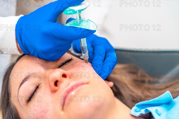Doctor injecting hyaluronic acid injection to the face of a woman during a rejuvenation beauty procedure