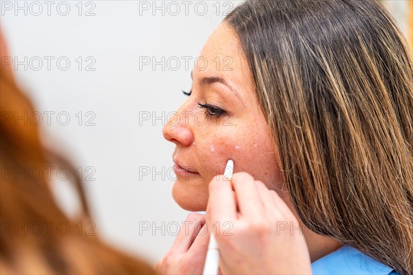 Woman before aesthetic surgery while doctor marking the lines to refill with collagen