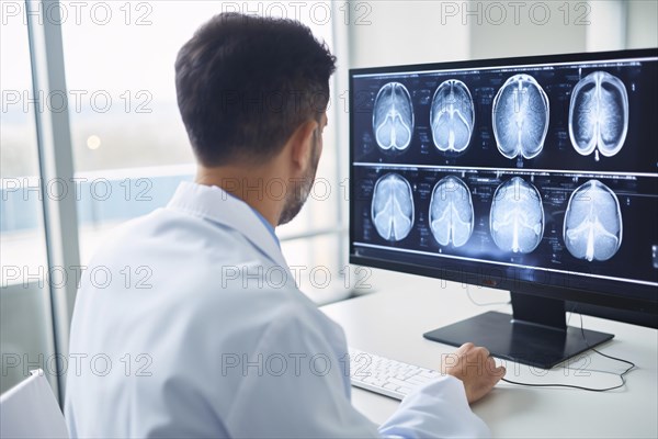Doctor looking at computer monitor with brains cans. KI generiert, generiert, AI generated