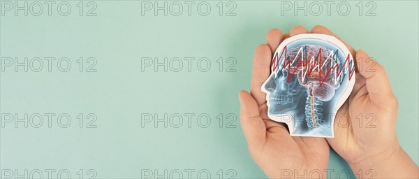 Epilepsy, brain with seizure, EEG, electrical activity of mind, alzheimer awareness, dementia diagnosis, Parkinson disease, memory loss disorder