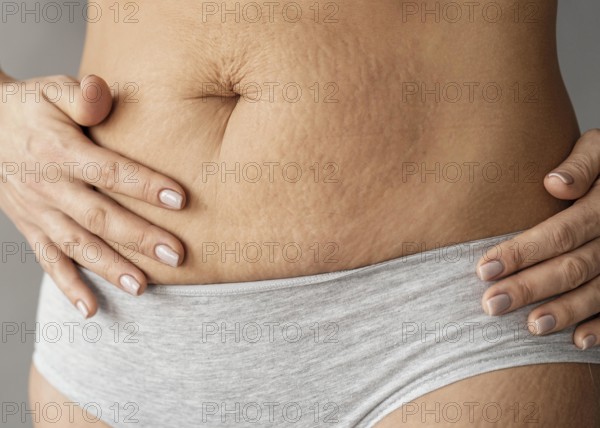 Close up woman with stretch marks. Beautiful photo