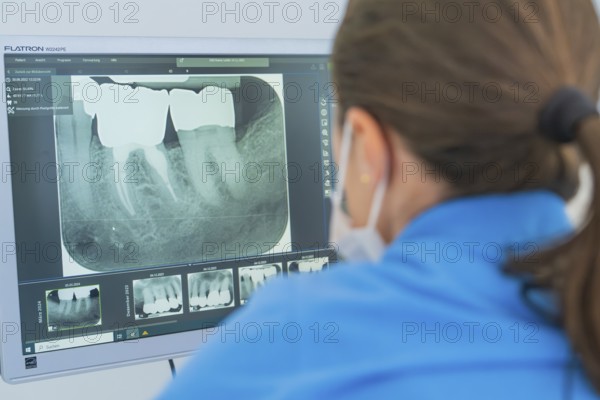 Dentist analysing X-ray images of teeth on a computer screen, dental practice, Germany, Europe