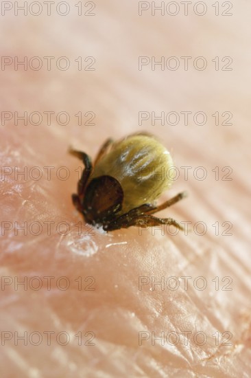 Tick bitten into human skin, common Castor Bean Tick (Ixodes ricinus), tick bite