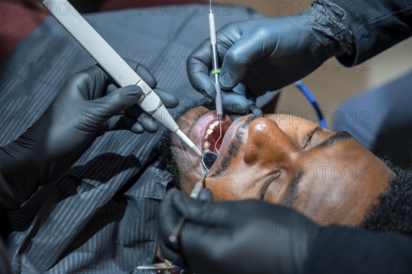 Close up of a dentist using specialized tools during a teeth whitening session on a male patient, highlighting professional dental care