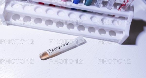 Test tube labeled Hantavirus placed near a rack in a lab setting
