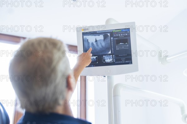 A person points to a screen with an X-ray image in a medical environment, dental practice, Germany, Europe