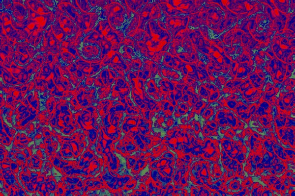 Lightning bolts radiatingas a background texture