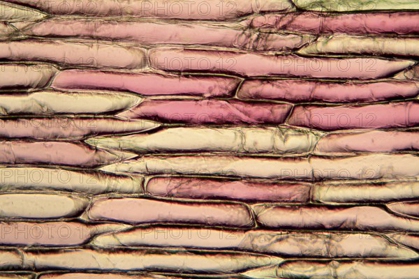 Onion cells under the microscope
