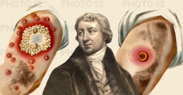 Edward Jenner, 1749-1823, English physician and scientist, digitally restored