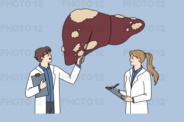 Diverse doctors in medical uniforms examine sick patient liver. Therapist make ultrasound body organ examinations. Hepatology therapy and healthcare. Flat illustration