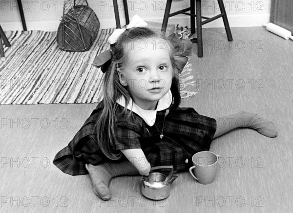 Thalidomide scandal. In the late 1950s and early 1960s, the use of thalidomide in 46 countries by women who were pregnant or who subsequently became pregnant, resulted in the biggest man-made medical disaster ever, resulting in more than 10, 000 children born with a range of severe deformities, such as phocomelia, as well as thousands of miscarriages. Thalidomide was introduced in 1956 and was aggressively marketed by the German pharmaceutical company Chemie Grünenthal under the trade name Contergan as a medication for anxiety, trouble sleeping, tension, and morning sickness. It was introduced as a sedative and medication for morning sickness without having been tested on pregnant women. While initially deemed to be safe in pregnancy, concerns regarding birth defects were noted in 1961, and the medication was removed from the market in Europe that year. 1966