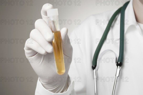 Doctor holding a bottle of urine sample