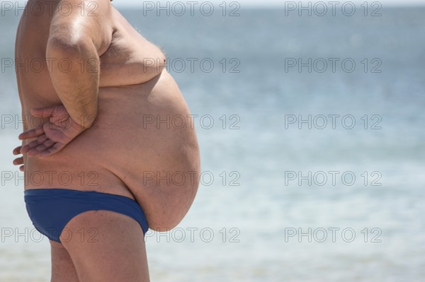 Side view of obese guy. Overweight man outdoor. Poor nutrition and sedentary lifestyle. Increased risk of heart illnesses