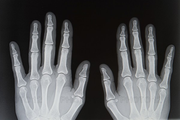 X-ray from human hands