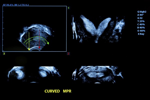 Colourful image of modern ultrasound monitor. Ultrasonography machine. High technology medical and healthcare equipment. Ultrasound imaging or sonography in medicine. Woman's womb during pregnancy