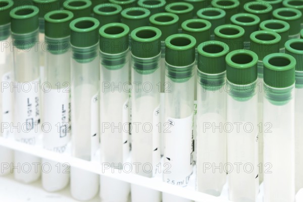 Covid-19 outbreak blood test. Close up view of empty test tubes for blood samples of Coronavirus patients, on a rack