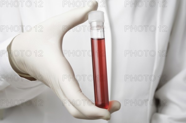 Doctor holding a bottle of blood sample