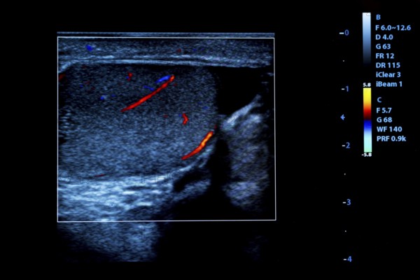 Colourful image of modern ultrasound monitor. Ultrasonography machine. High technology medical and healthcare equipment. Ultrasound imaging or sonography used in medicine