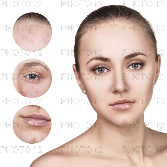 Portrait of young woman and circles shows problem skin over white background