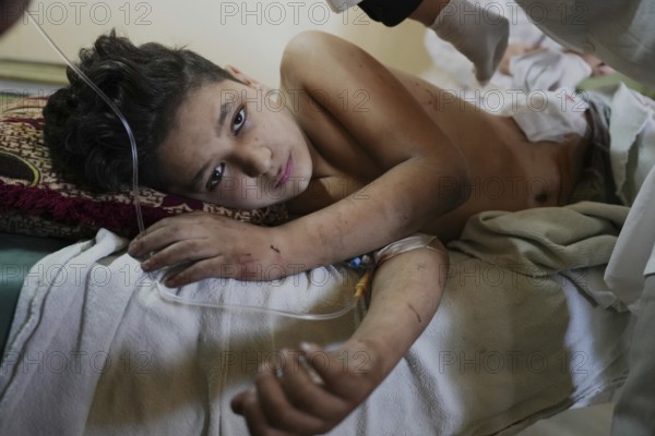 Wounded individuals receiving treatment at a hospital after being evacuated with difficulty from Sweida city in southern Syria due to sectarian violence between Druze factions and Bedouin tribes