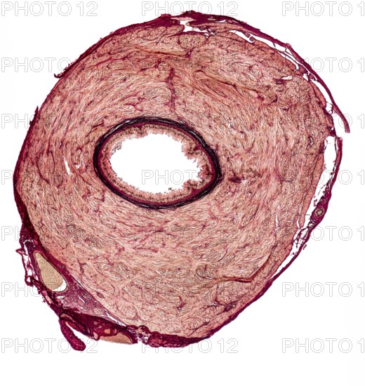 Microscopic cross section showing the vas deferens of a rat