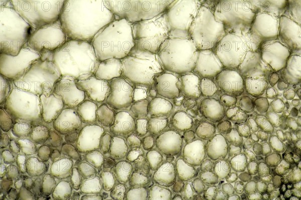 Full frame micrography showing the cell structure of a Bryophyllum plant