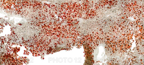 Full frame abstract microscopic detail of a human fatty liver