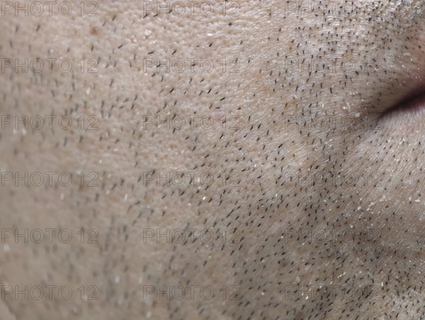 The skin of the man's face with stubble and flaky skin, sparse, gray hairs in the beard. Karaganda, Kazakhstan
