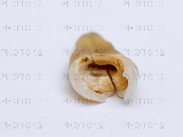 Pulled out, cracked and damaged, tooth, second premolar on a white background, Karaganda, Kazakhstan