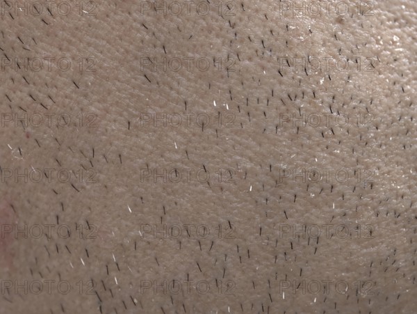 The skin of man's face with stubble and flaky skin, sparse gray hairs in the beard, Karaganda, Kazakhstan