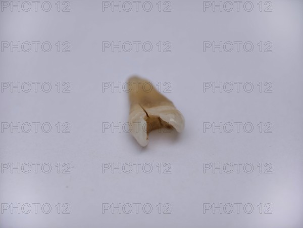 Pulled out, cracked and damaged tooth, second premolar on a white background. Karaganda, Kazakhstan