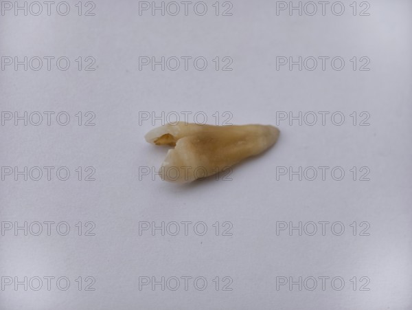 Pulled out, cracked and damaged tooth, second premolar on a white background, Karaganda, Kazakhstan