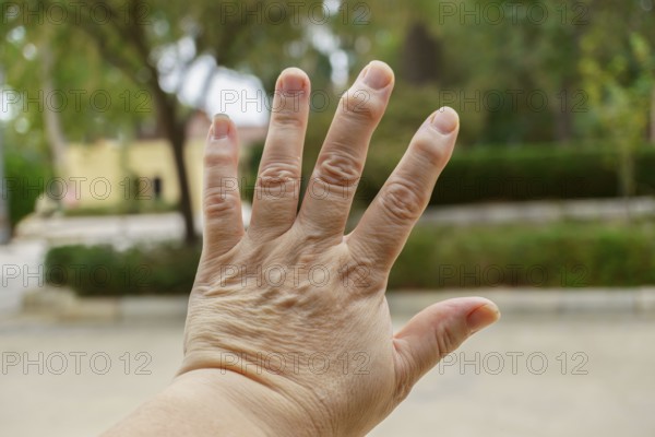 Close-up of wrinkled hand demonstrating osteoarthritis symptoms, highlighting age-related joint changes in ronda, malaga, spain