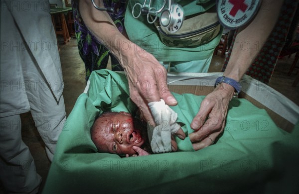 RWA Rwanda Kigali An injured Tutsi refugee child is receiving medical care in a makeshift hospital by doctors from Doctors Without Borders, MSF. It survived the genocide, which claimed the lives of 800, 000 people within 100 days. RWA Rwanda Kigali An injured Tutsi refugee baby in a temporary hospital run by Doctors without Borders