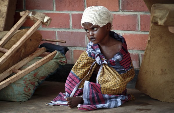 RWA Rwanda Kigali Injured Tutsi refugee children receive medical care in a makeshift hospital by doctors from Doctors Without Borders, MSF. They survived the genocide, which took the lives of 800, 000 people within 100 days. RWA Rwanda Kigali Injured Tutsi Refugee Kids in a Temporary Hospital Run by Doctors Without Borders