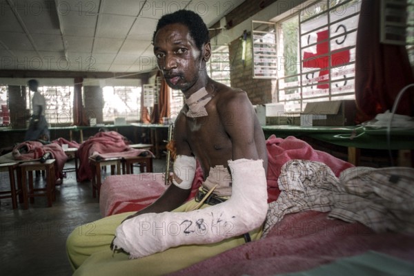 RWA Rwanda Kigali Injured Tutsi refugee receives medical care in a makeshift hospital by doctors from Doctors Without Borders, MSF. He survived the genocide, which took the lives of 800, 000 people within 100 days. RWA Rwanda Kigali An injured Tutsi refugee in a temporary hospital run by Doctors without Borders
