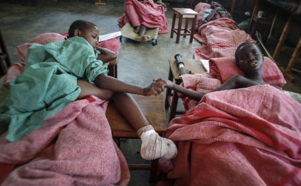RWA Rwanda Kigali Injured Tutsi refugee children receive medical care in a makeshift hospital by doctors from Doctors Without Borders, MSF. They survived the genocide, which took the lives of 800, 000 people within 100 days. RWA Rwanda Kigali Injured Tutsi Refugee Kids in a Temporary Hospital Run by Doctors Without Borders