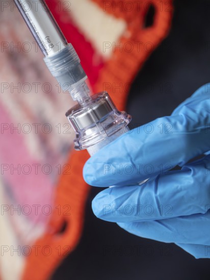Istambul, Turkey October 21st 2025 Nurse hand in blue glove holding Sandostatin injection, preparing somatostatin analog medication for patient treatment