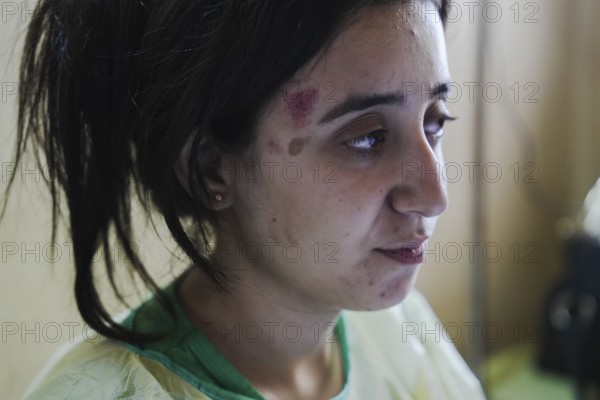 Wounded individuals receiving treatment at a hospital after being evacuated with difficulty from Sweida city in southern Syria due to sectarian violence between Druze factions and Bedouin tribes