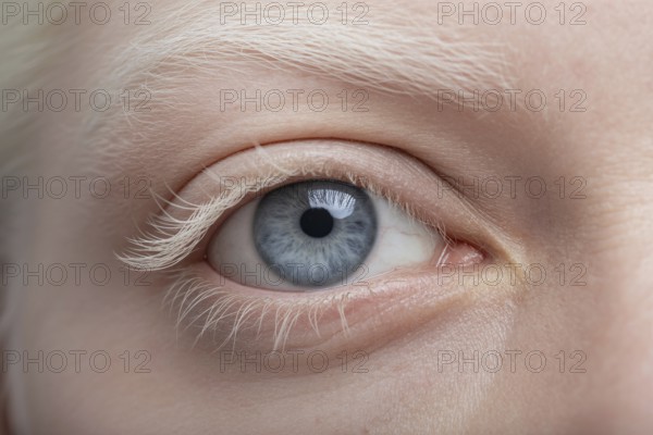 Close up of a woman's eye with white eyebrows and eyelashes, highlighting unique beauty of albinism. Generative ai, AI generated