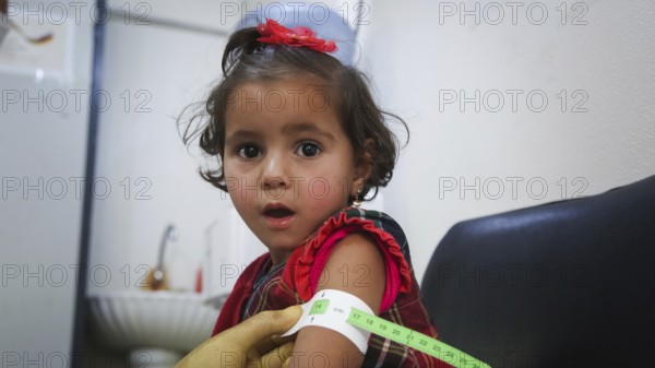 A doctor examines children's malnutrition inside a refugee camp. Malnutrition was measured using a mid-upper arm circumference belt. Aleppo, Syria October 29, 2022, Aleppo, Syria